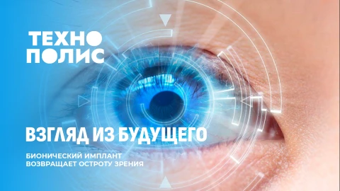 Технополис | ИИ обгоняет людей | Имплант для зрения | Птицы против машин Технополис | ИИ обгоняет людей | Имплант для зрения | Птицы против машин