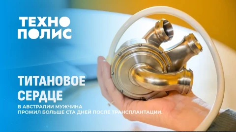 Технополис | Программисты больше не нужны? | Гуманоид отправится на Марс | Жизнь с титановым сердцем Технополис | Программисты больше не нужны? | Гуманоид отправится на Марс | Жизнь с титановым сердцем