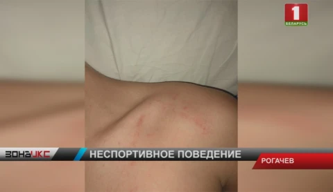 На детской площадке мужчина избил 12-летнего мальчика На детской площадке мужчина избил 12-летнего мальчика