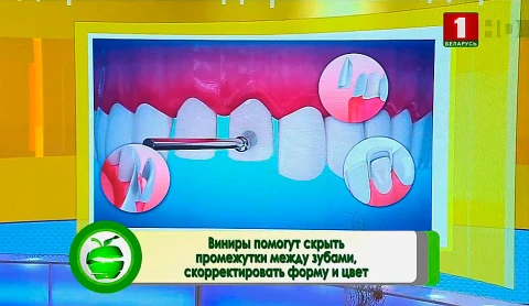 Виниры для зубов, табак и сердце, диагностика рака кожи, дробное питание - в программе "Здоровье" Виниры для зубов, табак и сердце, диагностика рака кожи, дробное питание - в программе "Здоровье"