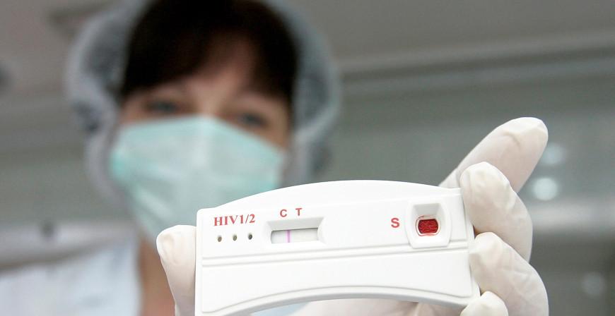 Заболеваемость ВИЧ-инфекцией в Беларуси за январь-май снизилась на 22,5%