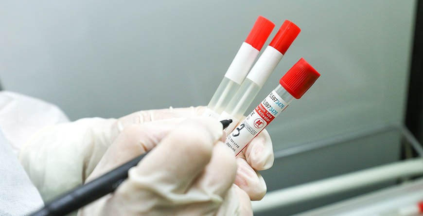 Директор Европейского регионального бюро ВОЗ считает, что пандемия завершится в 2022 году