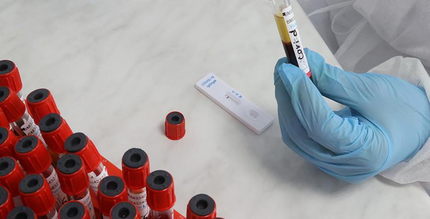 За сутки в Беларуси зарегистрированы 1982 пациента с COVID-19, выписаны 1607