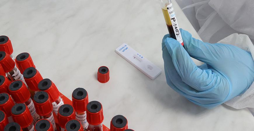 ВОЗ: число новых случаев заражения COVID-19 в мире выросло на 80% за последний месяц