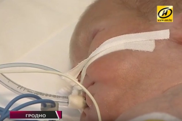 Хирурги провели сложную операцию новорождённому в Гродно