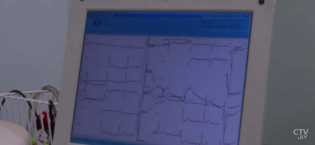 ekg210720.jpg