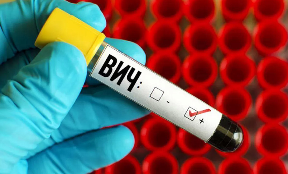 Как в Беларуси лечат людей с ВИЧ? Рассказывает специалист