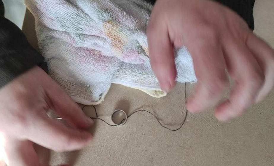 Слонимские спасатели помогли девочке снять застрявшее на пальце кольцо