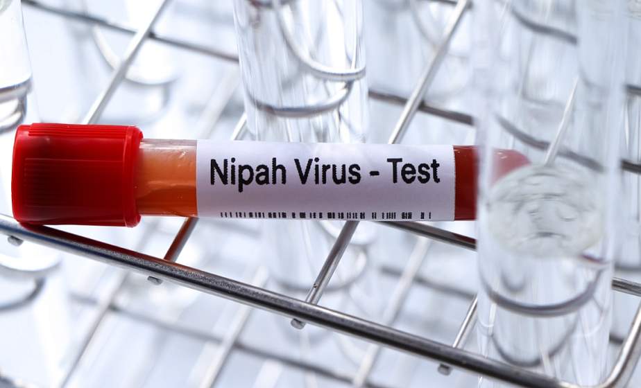 Вирус Нипах в Беларуси? В Минздраве рассказали, опасна ли болезнь для белорусов